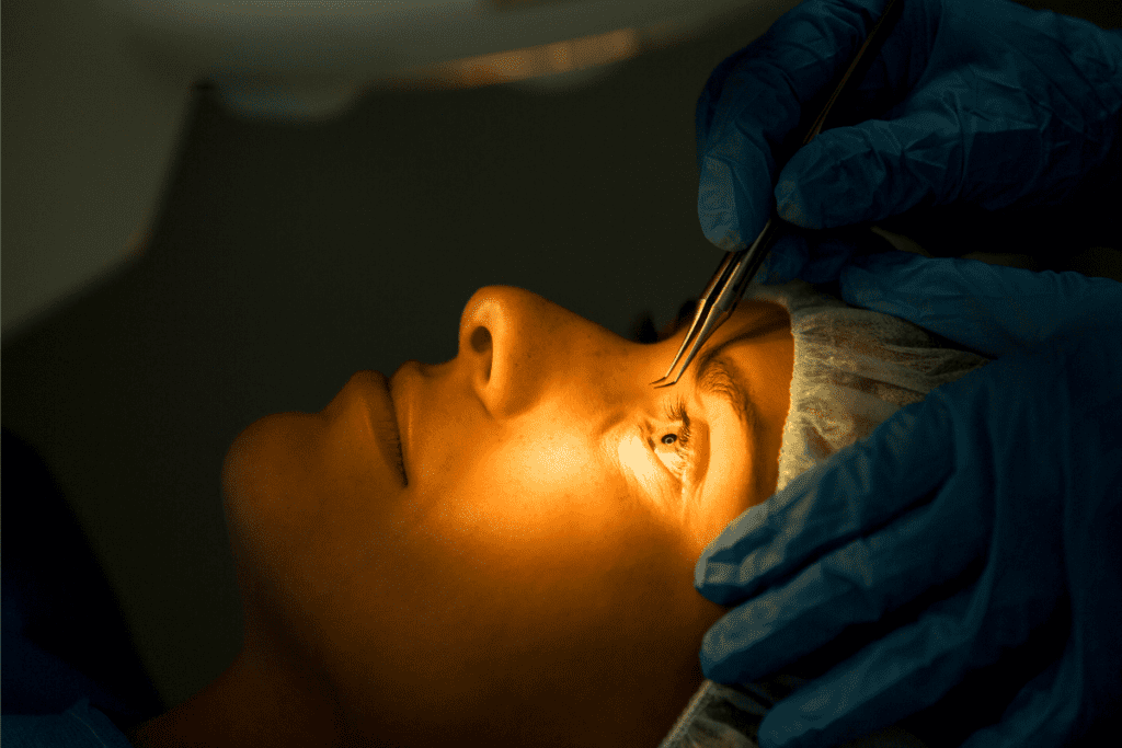 LASIK Eye Surgery Cost