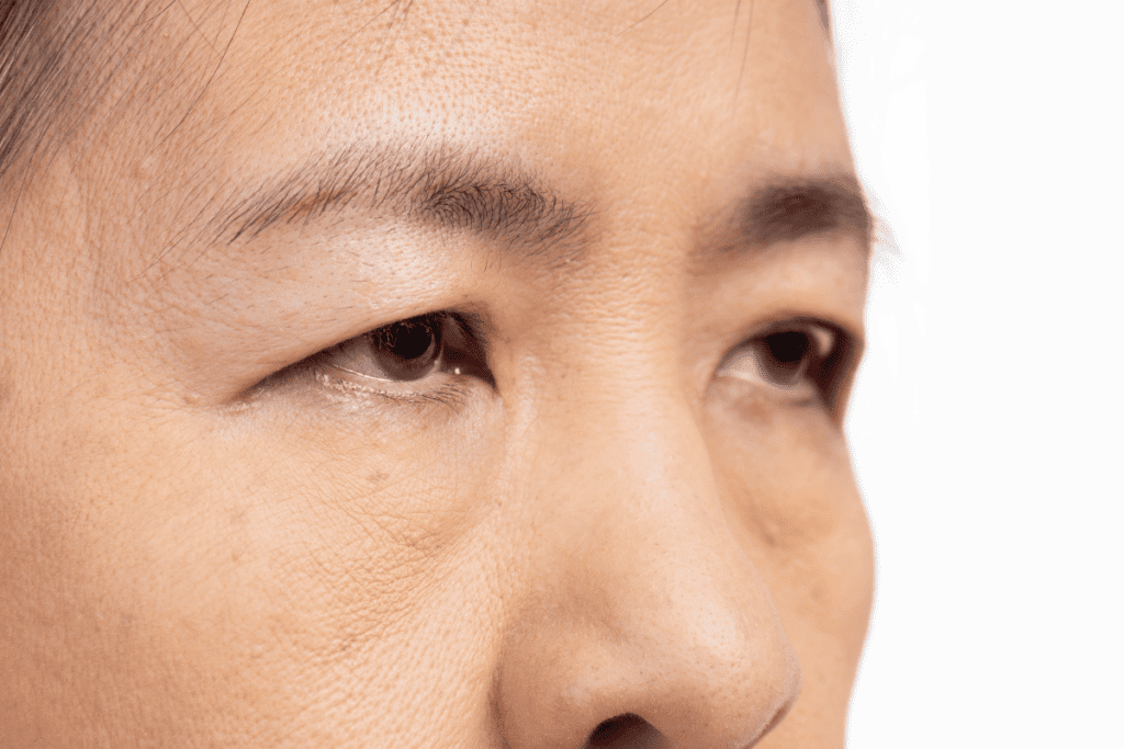 how to fix uneven eyelids